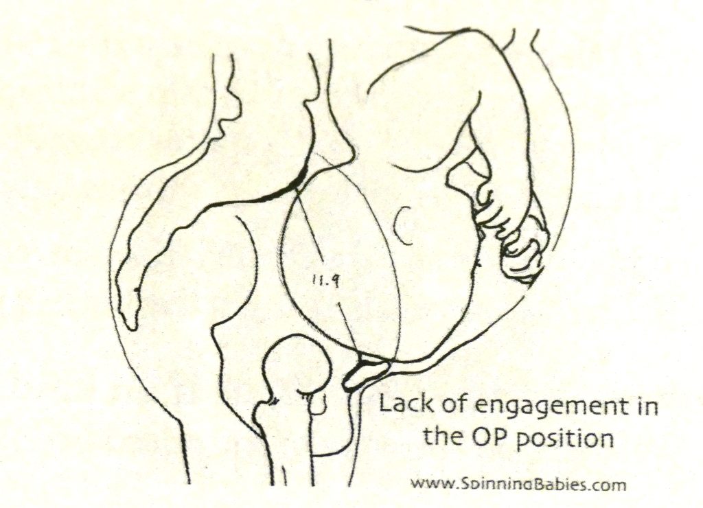 p1260592